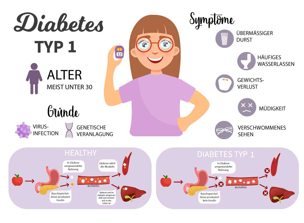 Diabetes Mellitus: Eine Übersicht Der Verschiedenen Formen